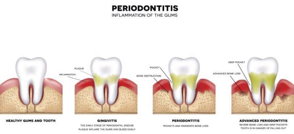 periodontist-westchester-ny